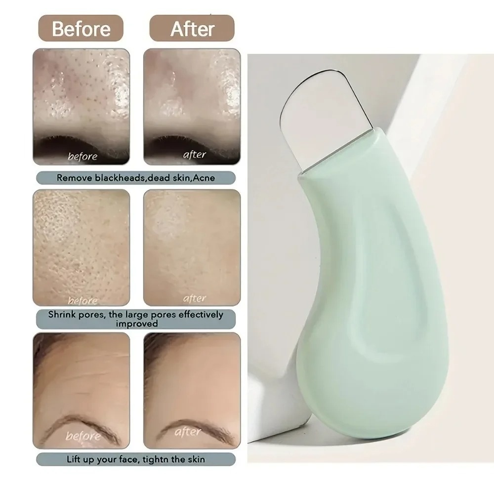 Dieptereinigende siliconen gez - Nasal Aspirator recensie en prijs
