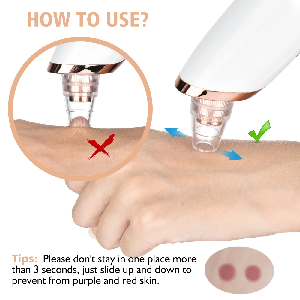 Comedondrukker Vacuüm Pore Cle - Nasal Aspirator recensie en prijs